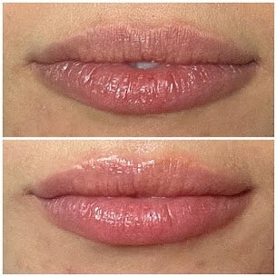 HydraFacial Perk Lip