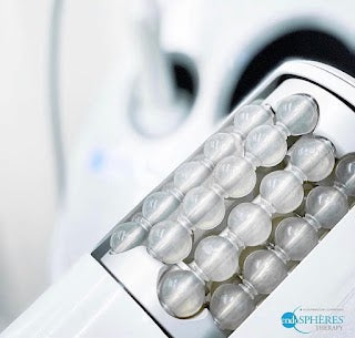 Have you tried Endospheres Therapy?