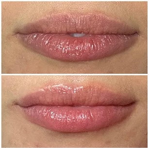 Perk Lip, from Hydrafacial!