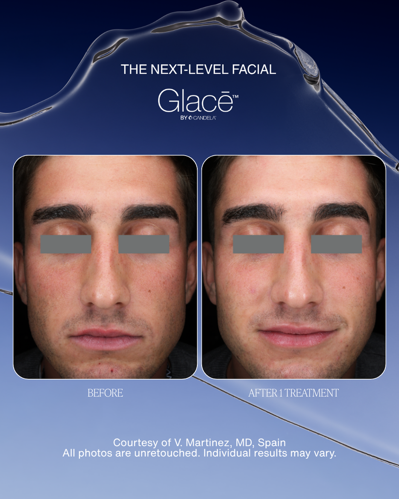 Are you ready for your before and after?