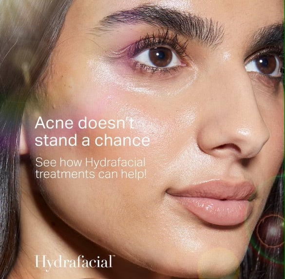 Why Acne-Prone Skin Is Flocking to the HydraFacial