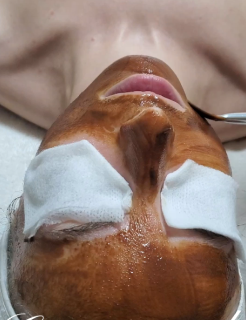 Customize Facial